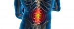 Back pain